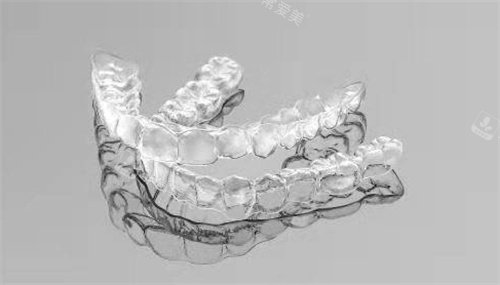 隐形牙套实例参考图