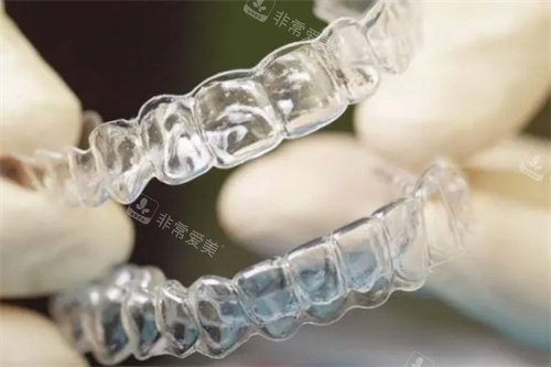 隱形矯正牙套模型圖 隱形矯正牙套模型圖