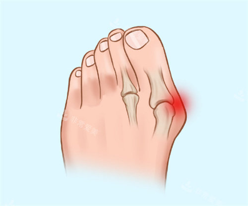 大腳骨的示意圖 大腳骨的示意圖