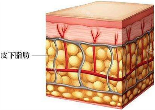 皮下脂肪圖片