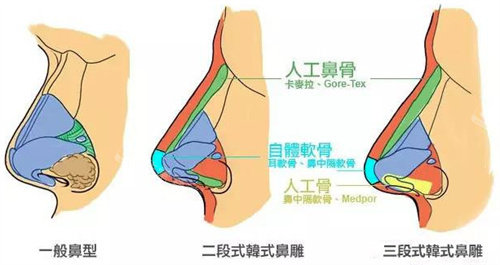 韩国原辰整形外科现在还火吗？挺火的去的人比较多！