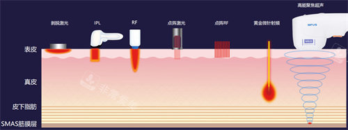 超声炮工作原理图