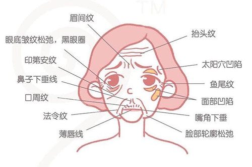 抗皱的影响力-皱纹对面部的影响卡通图示
