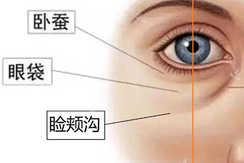 卧蚕位置照片