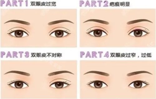 各种眼部问题示意图 各种眼部问题示意图