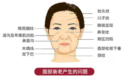 面部衰老產生的問題