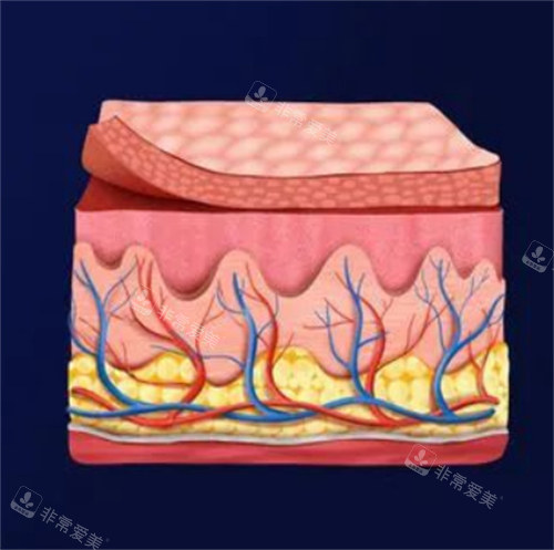 皮膚組織結(jié)構(gòu)