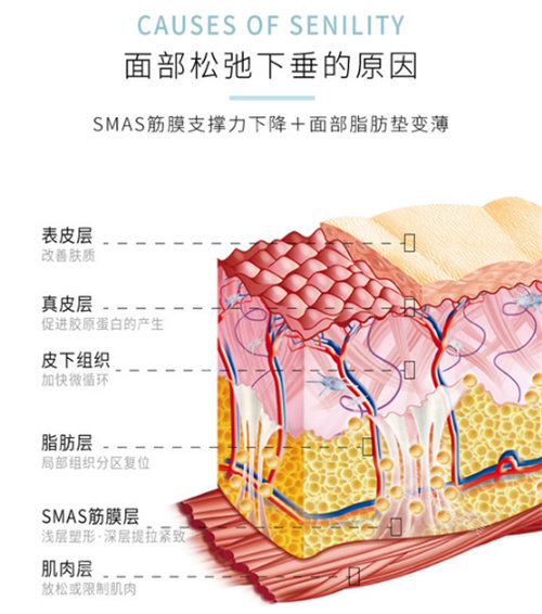 面部下垂的原因 面部下垂的原因