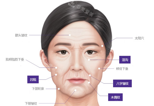 面部衰老引起的問題