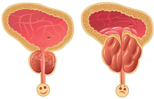 前列腺图