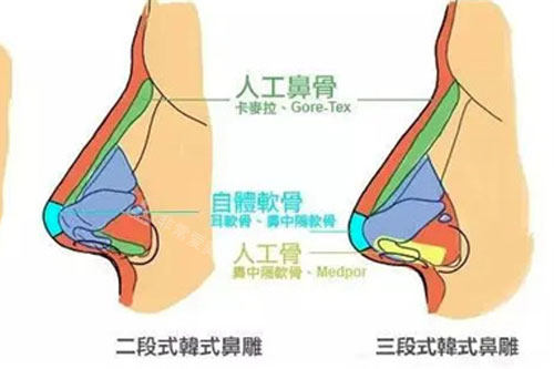 鼻型图