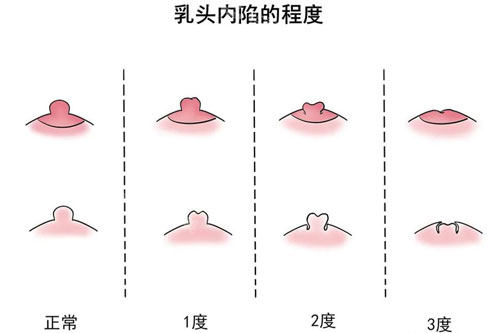 7101.1问答.jpg