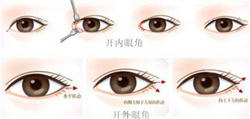 開眼角圖 開眼角圖