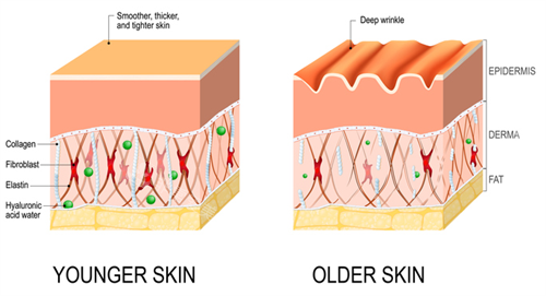 皮肤内物质的充盈决定了皮肤皱纹多少