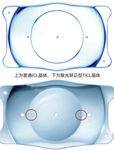 icl和ticl的区别