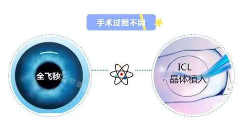 全飞秒近视眼与icl晶体区别