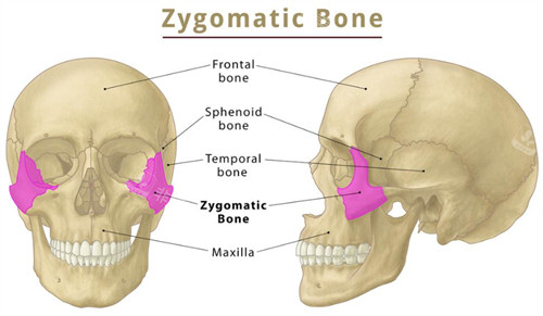 颧骨部位示意图