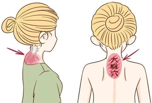 富贵包导致颈椎出现问题
