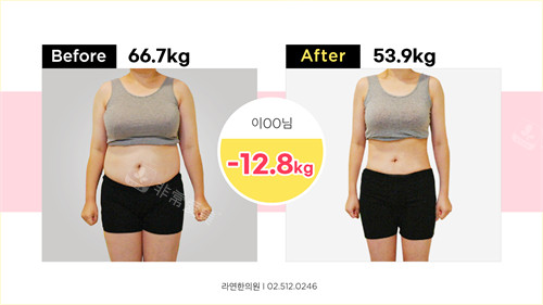 韩国罗然韩整形减肥前后对比图