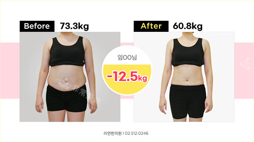 使用韩国罗然瘦瘦汤减肥前后对比