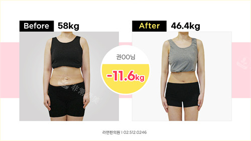 韩国罗然韩整形排毒减肥前后对比图