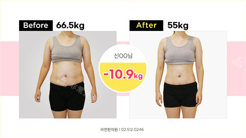 韩国罗然韩医减脂减肥前后对比图