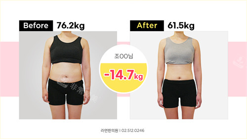 韩国罗然韩医减脂金澯佑医生体重改善前后对比
