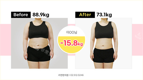 韩国罗然韩医减脂代谢减肥瘦身前后对比