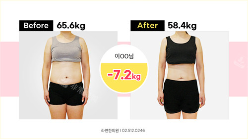罗然韩医减脂减肥前后对比