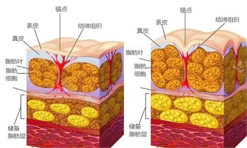 脂肪变化示意图
