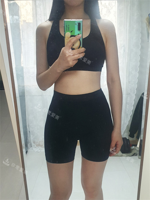 在韓國普蘭斯醫(yī)院服用韓方減肥藥減肥后 在韓國普蘭斯醫(yī)院服用韓方減肥藥減肥后
