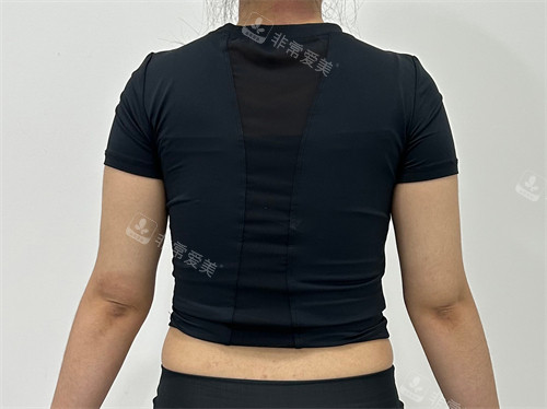 在韓國普蘭斯醫(yī)院服用韓方減肥藥減肥后 在韓國普蘭斯醫(yī)院服用韓方減肥藥減肥后