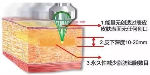 5G天使光雕