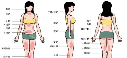 5G吸脂的部位