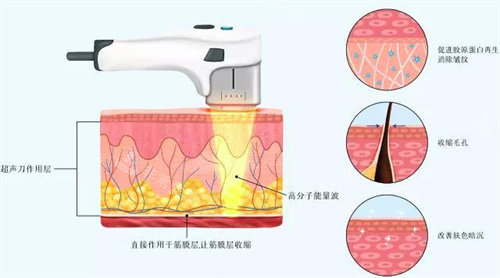 超声炮原理图