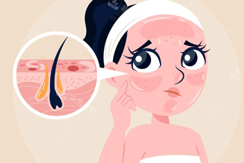 毛孔粗大、黑头多的样子