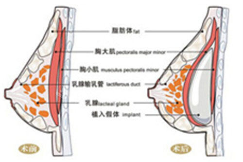 胸部图