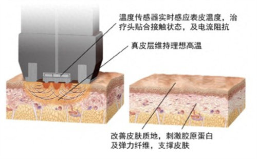 钻石超塑原理