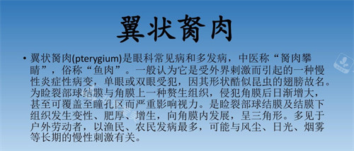翼状胬肉介绍