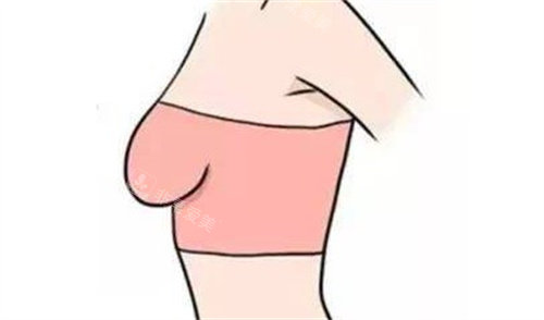 胸部麻木 胸部麻木