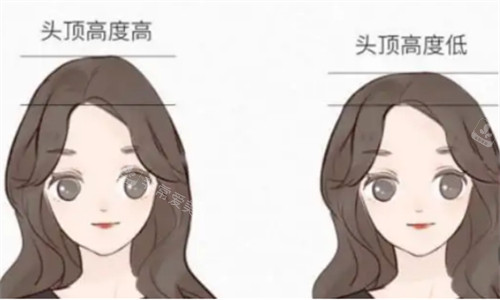高顱頂與低顱頂?shù)膶Ρ葓D 高顱頂與低顱頂?shù)膶Ρ葓D