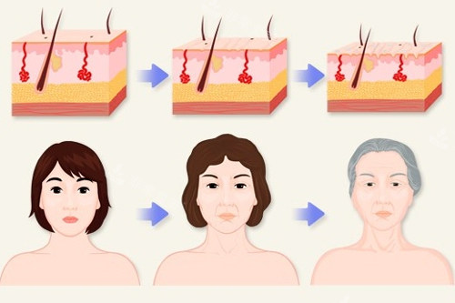 不同年龄面部的变化图解