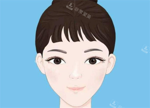 雙眼皮修復后成效圖 雙眼皮修復后成效圖