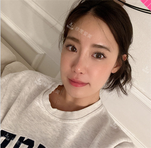 韓國褔萊澤pleasure整形外科做鼻子后圖片