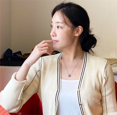 韓國褔萊澤pleasure整形外科做鼻子后側(cè)面圖