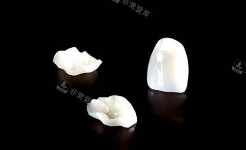 牙貼面材料圖片 牙貼面材料圖片