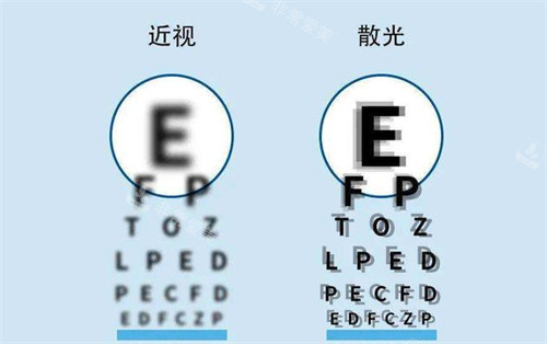 散光和近视看东西的区别