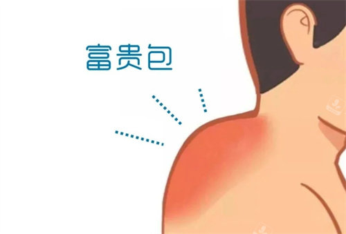 富貴包動(dòng)畫(huà)圖 富貴包動(dòng)畫(huà)圖