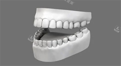 牙齿模型图示