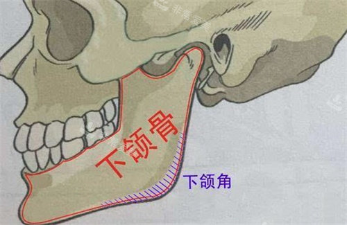 下颌角改善